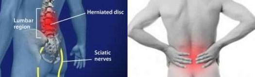 Indicazioni terapeutiche