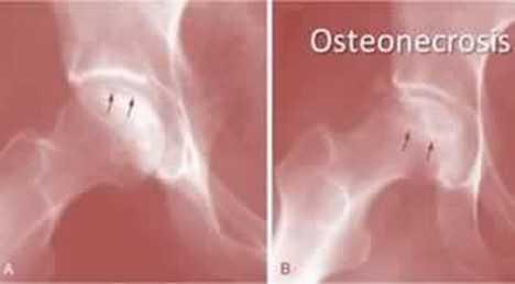 Indicazioni terapeutiche