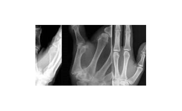 Indicazioni terapeutiche